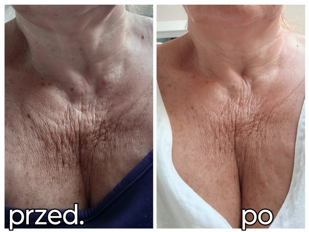 Obrazek #1 z Danuta Kurzeja